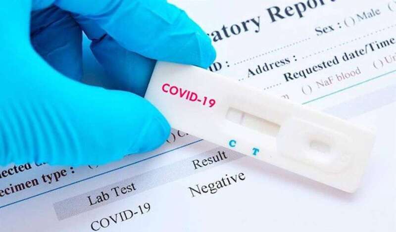 Imagen de archivo de un test rápido de covid-19 (Foto TA)